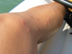 And the many mosquitoe bites I have on my leg that I got earlier when preparing the canoe